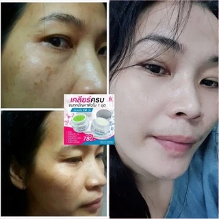 ครีมบริ้งไวท์ ครีมแก้ฝ้า รักษาสิว บำรุงหน้าใส (ส่งฟรีมีปลายทาง🎁 มีของแถม)
