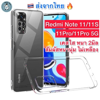 เคส Redmi Note 11 / 11S / 11Pro / 11Pro 5G เคสใส กันกล้อง กันกระแทก