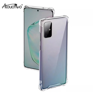 เคสKingkong คิงคอง เคสใสกันกระแทก ขอบนิ่มหลังแข็ง Case OPPO Reno8 8Z 8P A96 Reno7 7Z 7Pro RealmeC35 9i 9Pro C25 Atouchbo