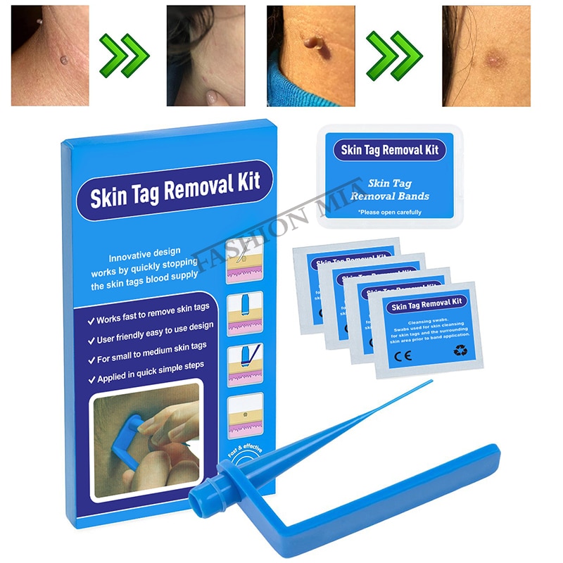 home use skin tags remover kit remove warts body skin care tools wart