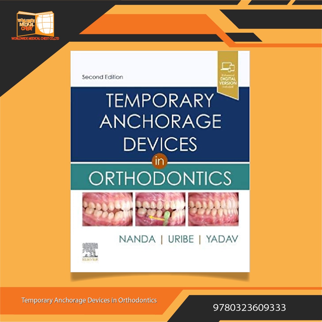 Temporary Anchorage Devices in Orthodontics