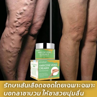 SEFUDUNครีมทาเส้นเลือดขอด50g ช่วยให้การไหลเวียนของเส้นเลือดขอดดีขึ้น บรรเทาอาการปวด ขนาด50กรัม