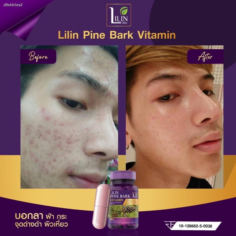 ส่งตรงจากกรุงเทพLILIN Pine Bark Vitamin  ผลิตภัณฑ์เสริมอาหาร ลิลิน ไพน์บาร์ค วิตามิน วิตามินผิว ลดฝ้