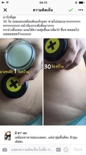โปรตีนบัวหิมะ แก้ผดผื่น แก้รอยแตกลาย ใช้ได้ตั้งแต่เด็ก3ขวบ