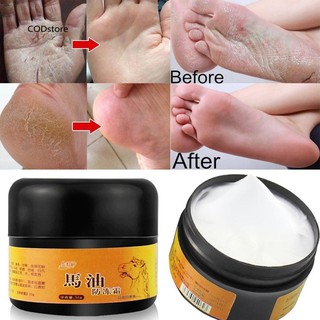 CST❤30g Mild Feet Itch Hand Dry Foot Crack Cream Deep Nourish Skin Care Ointment