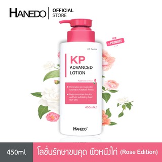 Hanedo โลชั่นรักษาขนคุด ผิวหนังไก่ สิวที่หลัง ผลัดเซลลผิวให้เรียบเนียน Hanedo KP Advanced Lotion Plus Rose Extract 450ml