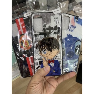 Case Redmi Note 10 5G (ส่งจากไทย)