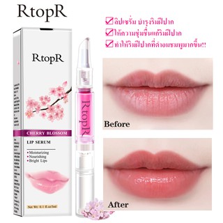 Rtopr ลิปบาล์ม ลิปมัน ลิปเซรั่ม Cherry Blossom Lip Serum ลิปเซรั่มบำรุงริมฝีปาก 3 ml.