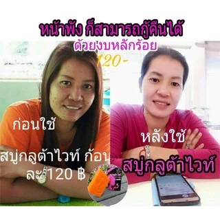 🍊สบู่กลูต้าไวท์ BMK SKINCARE 🍊 ช่วยผลัดเซลล์ผิว เพิ่มความใส✨