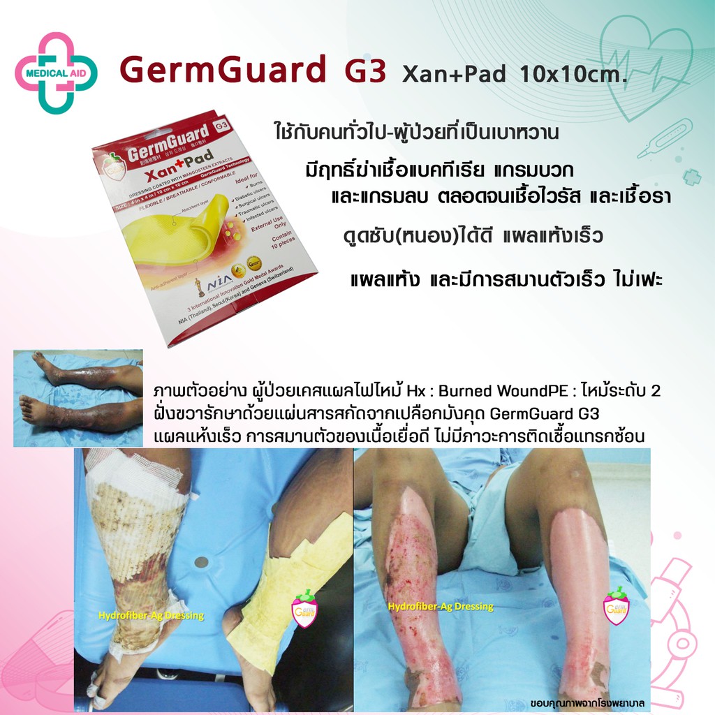 *ค่าส่งเริ่ม24บาท/ผ้าก็อชปิดแผลแบ่งขายGermGuard G3 10x10cm.ใช้กับคน (พร้อมส่ง)​