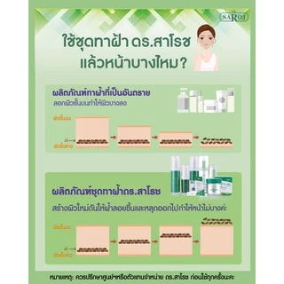 ดร.สาโรช ไฮ-โกล โลชั่นรักษาฝ้าสูตรเข้มข้น สำหรับผิวมัน (Dr.Saroj Hi-Glow)
