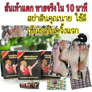 สปาตีนคุณนาย แก้ส้นเท้าแตก  ของแท้100% (มีบริการเก็บเงินปลายทาง)