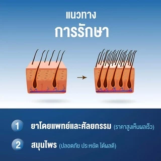 ยาปลูกผม Alotis อโลทิส ปลูกผม ลดผมร่วง ลดผมบาง หัวล้าน หัวเถิกไข่ดาว รากผมแข็งแรง เห็นผลจริง มีรีวิว