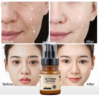 【DREAMER】VIBRANT GLAMOUR Retinol Lotion Whitening Moisturizing Hydrating Shrink Pores Anti Aging Anti Wrinkle Skin Care