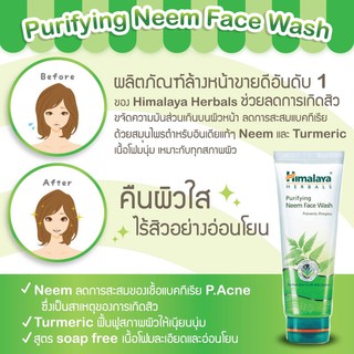 Himalaya หิมาลายานีมเฟสวอช 100ml