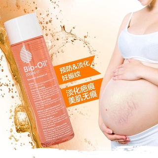 Bio Oil 200 ml ไบโอ-ออยล์ ออยสารพัดประโยชน์ ลบรอยแผลเป็น ผิวแตกลาย