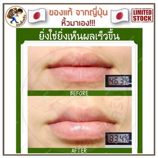 [พร้อมส่ง] Mentholatum Medicated XD Lip Stick ลิปบาล์ม ยอดนิยมจากญี่ปุ่น ลิป เมนโทลาทัม