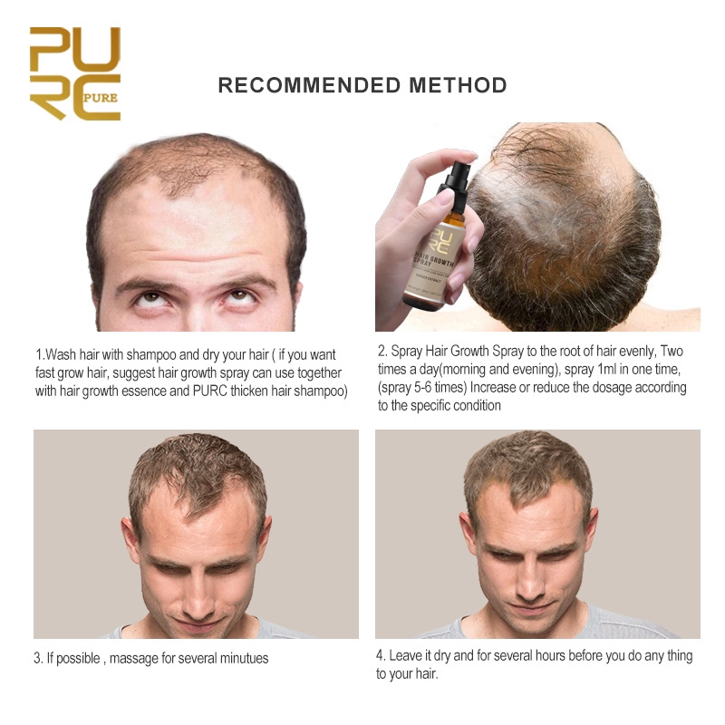 New 30ml Purc Hair Growth Spray Extract Prevent Hair Loss Growing