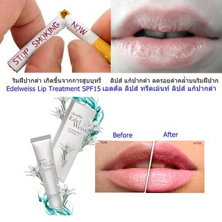 🔥ส่งฟรี🔥มีโปร🔥 ลิปทาปาก เนื้อเนียนนุ่ม บำรุงปากขั้นเทพ | เอดดัลไวส์ ลิปทรีทเมนท์ กิฟฟารีน​