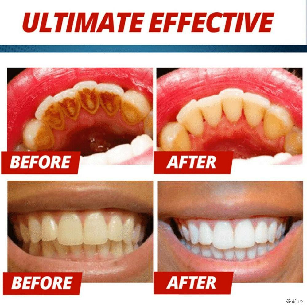 №Stain Removal Whitening Toothpaste Fight Bleeding Gums Toothpaste
