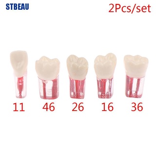 [STBEAU1] โมเดลฟันเรซิ่น 2 ชิ้น สําหรับฝึกซ้อมช่องปาก