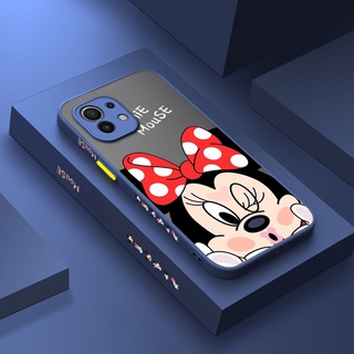 เคสแข็ง ซิลิโคน ใส ลายการ์ตูนมินนี่เมาส์ สําหรับ Xiaomi 11 Lite 5G Ne 11 Pro Ultra