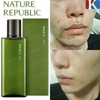 NATURE REPUBLIC SNAIL SOLUTION HOMME SKIN