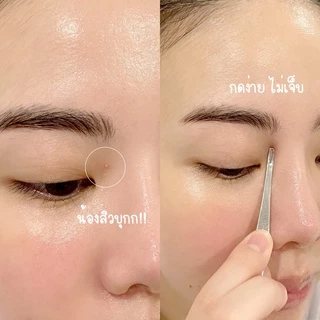 หมอมวลชน เซท D ที่กดสิว + Accin Cooling Mud Mask 5 กรัม+ กล่องเก็บที่กดสิว + เจลล้างหน้า ไรฟา 15 ขนาด 7 กรัม