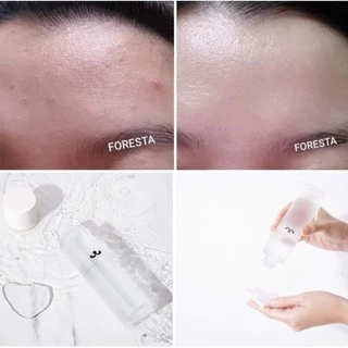 (ตัวแทน) FORESTA BALANCING TONER 150ml. โทนเนอร์วีแกน