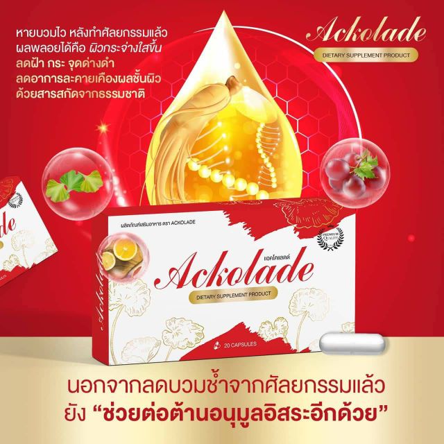 ส่งฟรี/โค้ดลด) อาหารเสริม​สมุนไพร​ลด​อาการ​บวมหลังทำศัลยกรรม แอคโคแลดด์  (Ackolade)​ | Shopee Thailand