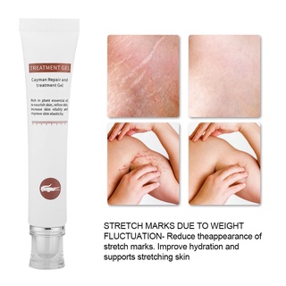 Fairy &amp; Magic Stretch Marks Postpartum Repairing Cream Obesity Pattern Diluting Removal