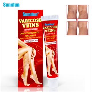 Sumifun Varicose พลาสเตอร์บรรเทาอาการปวดเส้นเลือดขอดร่างกาย 20กรัม