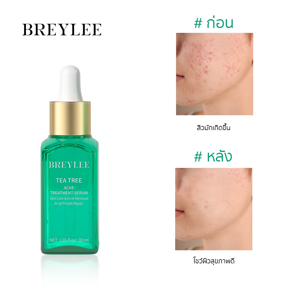 BREYLEE เซรั่มทรีทเม้นท์รักษาสิวทีทรี กำจัดสิว หน้าใส เซรั่ม 30มล acne treatment skin care serum