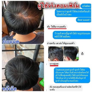 Increase magic hairs สเปรย์เซรั่ม ปิดผมบาง ผมขาว ไซส์พกพา75ml.