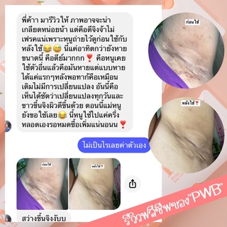 ‼️3 หลอด ส่งฟรี‼️รักแร้ขาวขึ้น รอยดำจางลง❗️ใช้เอง~เห็นผลจริง~ถึงกล้าขาย❗️