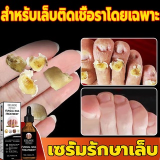 【 ปรับปรุงเล็บให้แข็งแรงและมีสุขภาพดีใน3สัปดาห์！】EELHOE เซรั่มซ่อมแซมเล็บ 50ml เชื้อราเล็บ เชื้อราที่เล็บ ฆ่าเชื้อราเล็บ