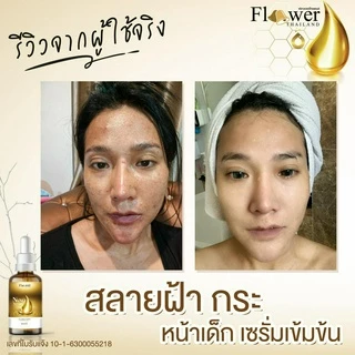 [ส่งฟรี/ของแท้] *1แถม1* Nano Serum เซรั่มนาโน แก้ฝ้า หน้าคล้ำ รอยสิว รอยดำ ผิวกระจ่างใส ของแท้100%
