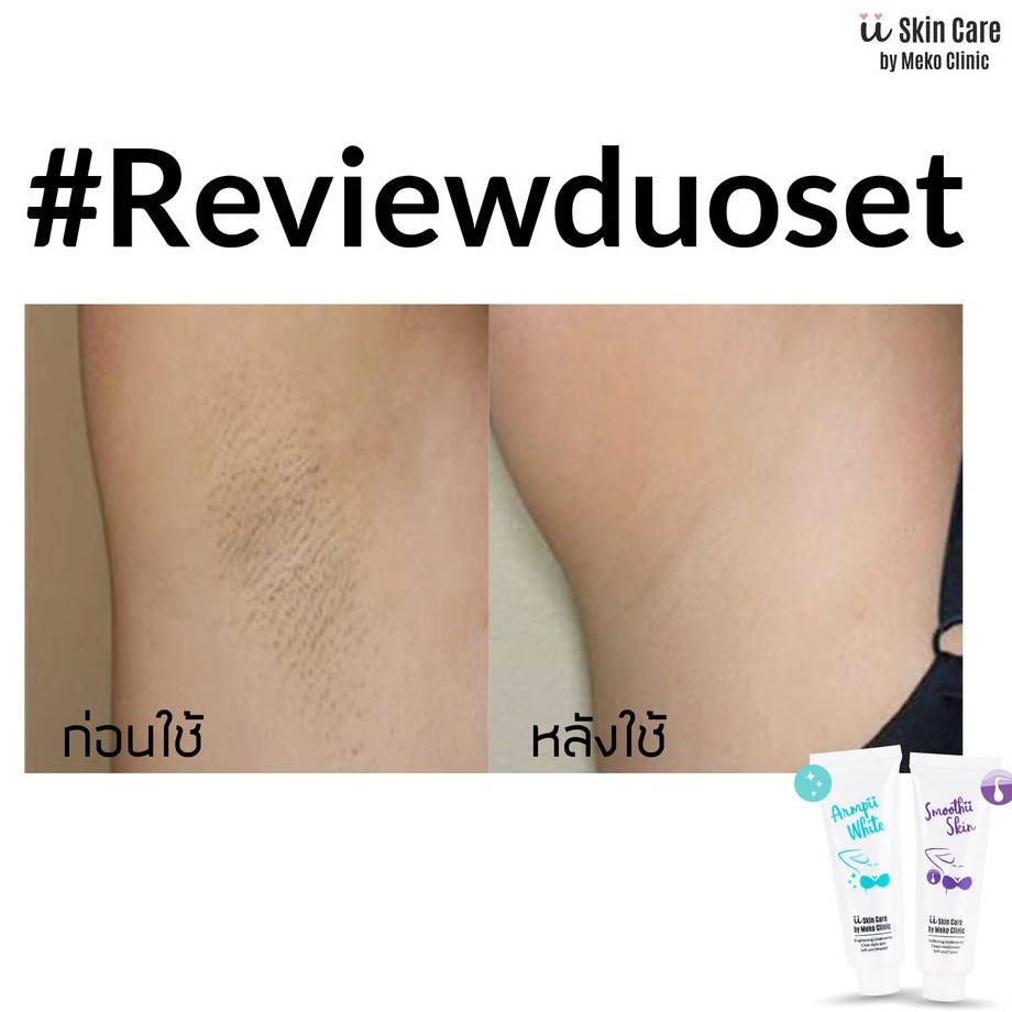 ครีมทารักแร้เนียน Smoothii Skin ii Skincare by Meko Clinic (30 ml) - รูปที่ 4