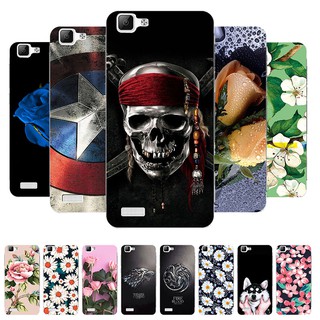 เคสโทรศัพท์พลาสติกสำหรับ VIVO Y 35 Hard