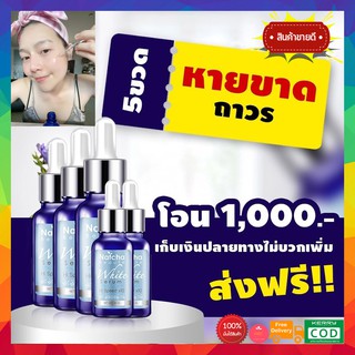 ((5ขวด ของแท้)) เซรั่มณัชชา serum Natcha White ขนาด 30ml 1 ขวด ฝ้า กระ สิว หน้าดำ รีบสั่ง 5ปีแล้วเซรั่มณัชชา