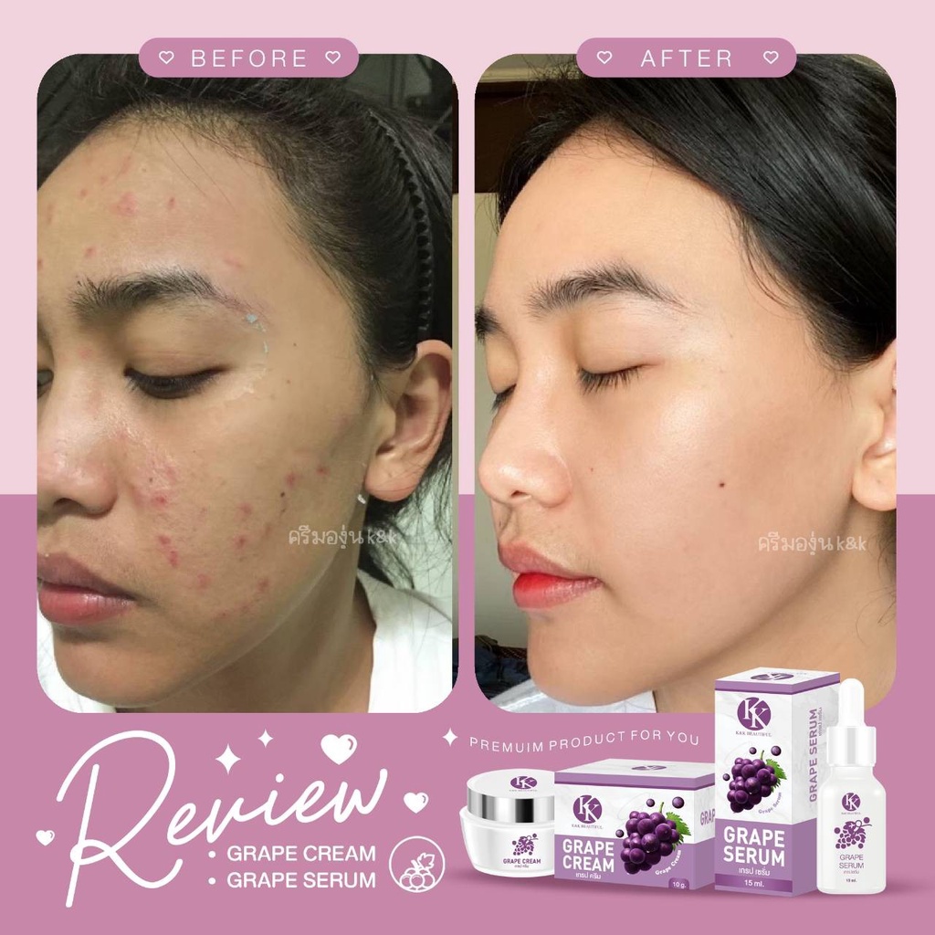 เซรั่มองุ่นมินิ ลดริ้วรอย หน้าหมองคล้ำ ขนาดพกแพ้ แท้ 100% - รูปที่ 3