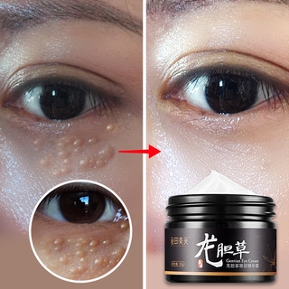 Gentian eye Cream Remove Fat granules fade eye bags to Dark Circles, Moisturizing Eye Essence，Remove Black Eyes, puffiness,Fine Lines