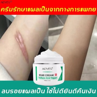 ALIVER ครีมลดรอยแผลเป็น ครีมลบรอยแผลเป็น50mlแผลไฟไหม้  ครีมลบแผลเป็น ครีมรักษาแผลเป็น ครีมกำจัดรอยแผลเป็น น้ำร้อนลวก