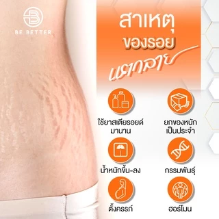 ครีมลดรอยแตกลาย Be better 1ขวด น้ำตบสยบรอยแตก ครีมขาลาย ก้นลาย ครีมแก้ท้องลาย