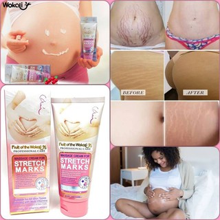 Fruit of the Wokali Stretch Marks ครีมบำผิวท้องลาย น่องลาย แก้ปัญหาผิวลายให้กลับมาเนียนธรรมชาติ ยอดฮิตจากห้างหรู