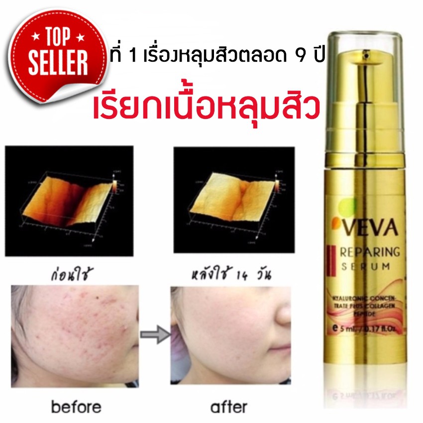 VEVA Repairing Serum เซรั่มเรียกเนื้อหลุมสิว หน้าหลุมรอยสิว รอยดำรอยแดง เติมเต็มหลุมสิว 10 ml.