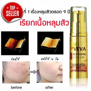 VEVA Repairing Serum เซรั่มเรียกเนื้อหลุมสิว หน้าหลุมรอยสิว รอยดำรอยแดง เติมเต็มหลุมสิว 10 ml.