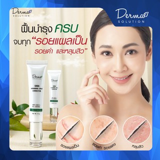 Skin Repairing Spot Corrector(15g)หลุมสิว รอยแผลเป็น แก้หลุมสิว รอยแผลเป็นจากสิว รักษาหลุมสิว ยาลดรอยแผลเป็นจากสิว