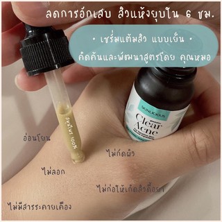 ที่แต้มสิว Skinlicious หัวสิวแห้งไว ลดการอักเสบ ป้องกันการเกิดสิว