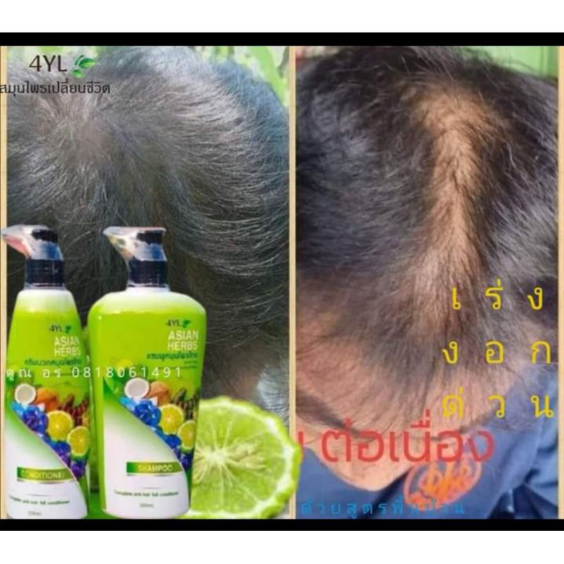 แชมพูสมุนไพรแท้​ 4YL